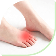 高尿酸血症(痛風)